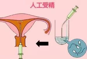 浙江助孕