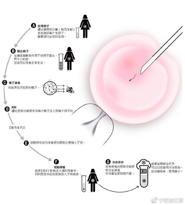 泰安不孕