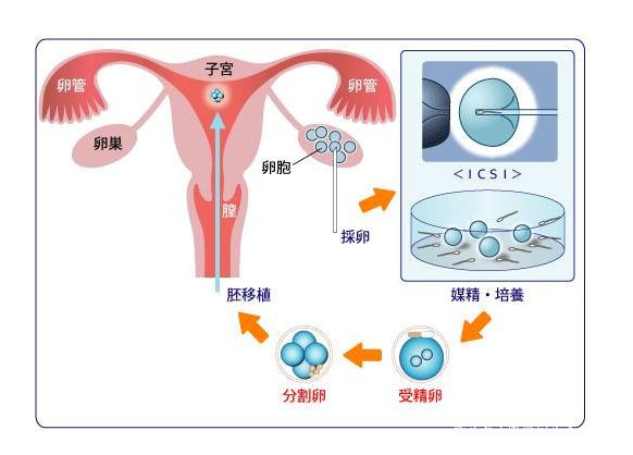 海外试管婴儿医院