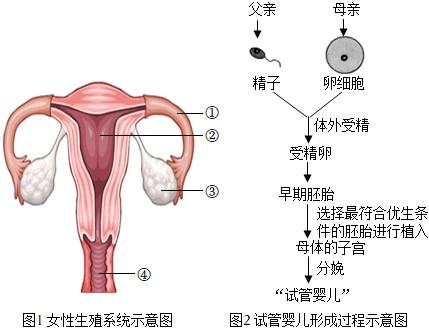 海口试管婴儿