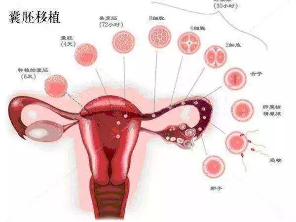 海外助孕