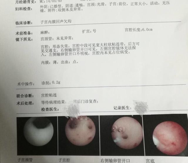 海口试管婴儿